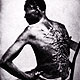 Cicatrices de flagellation sur un esclave en Louisiane