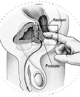 dessin anatomie masculine - la prostate 